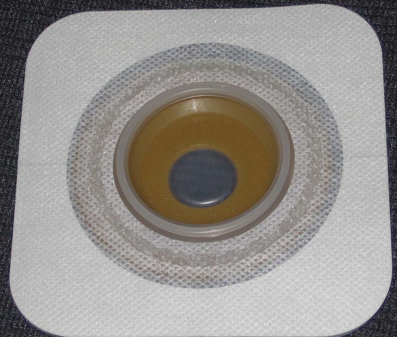 Ileostomy-Base-Plate